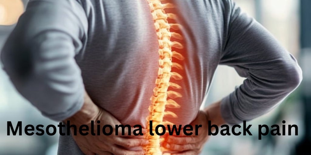 mesothelioma lower back pain