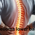 mesothelioma lower back pain